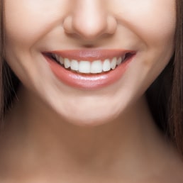 Teeth Whitening Experts in Newcastle And Singleton