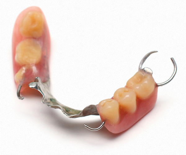 MS Dental - Partial Dentures - Cardiff - Singleton - Fletcher - Newcastle