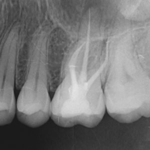 Dental checkups Cardiff