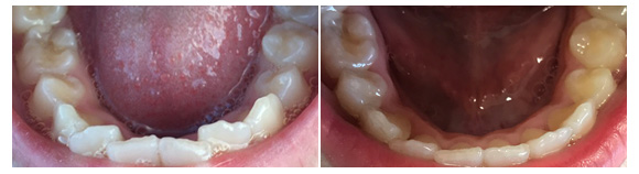 MS Dental - True Line