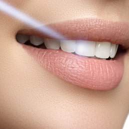 Laser Dental Treatments