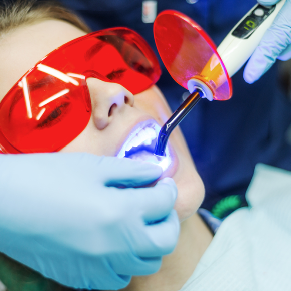 Laser Dental Treatments