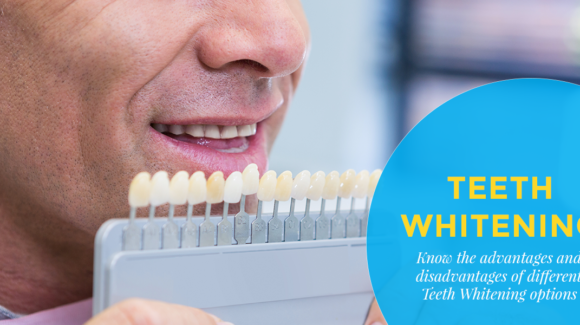 Teeth Whitening – Which is the best option for you?