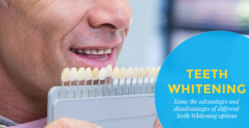 Teeth Whitening – Which is the best option for you?