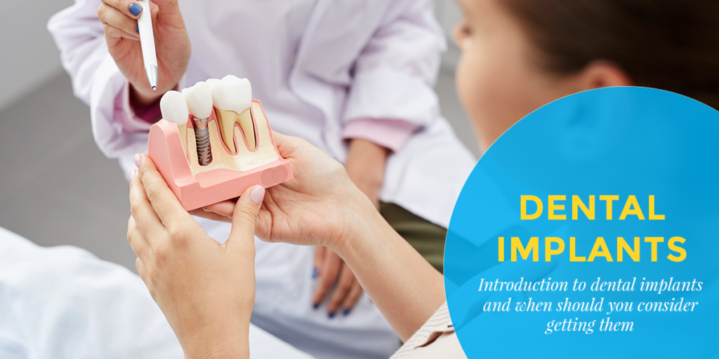 Dental Implants Indroduction to Dental Implants and When Should You Consider Getting Them