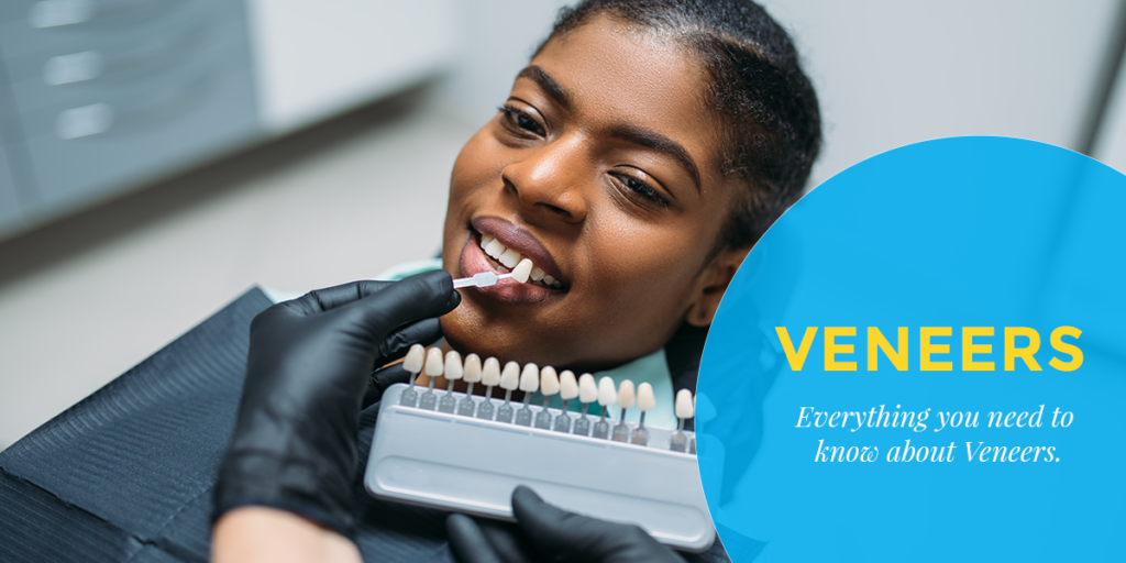Dental veneers for improving smile appearance