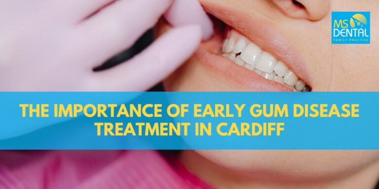 The Importance of Early Gum Disease Treatment in Cardiff