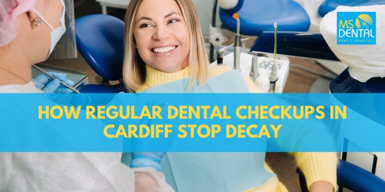 How Regular Dental Checkups in Cardiff Stop Decay