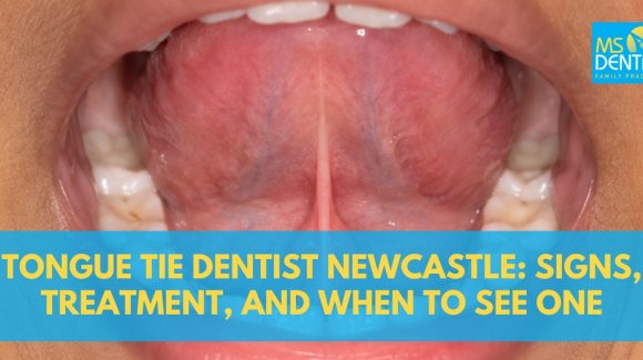 Tongue Tie Dentist Newcastle: Signs, Treatment, and When to See One Tongue Tie Dentist Newcastle: Signs, Treatment, and When to See One