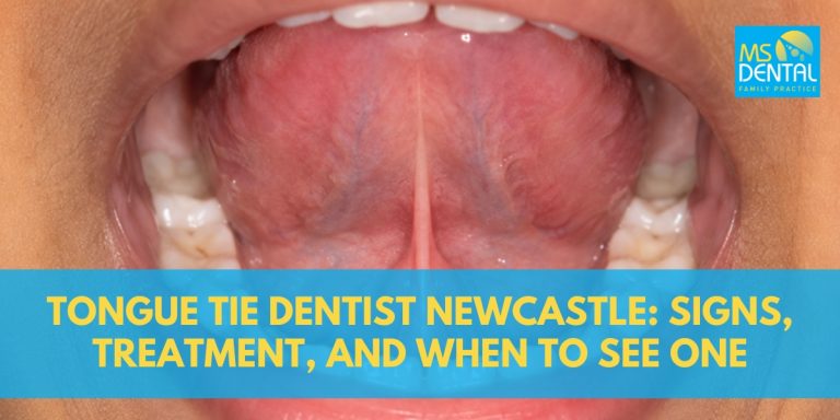 Tongue Tie Dentist Newcastle: Signs, Treatment, and When to See One