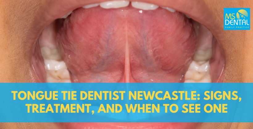 Tongue Tie Dentist Newcastle: Signs, Treatment, and When to See One Tongue Tie Dentist Newcastle: Signs, Treatment, and When to See One