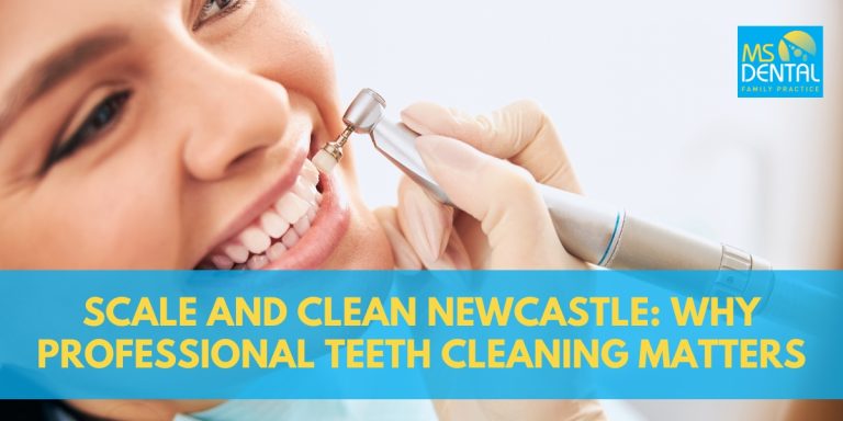 Scale and Clean Newcastle: Why Professional Teeth Cleaning Matters