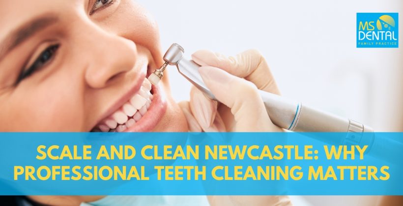 Scale and Clean Newcastle: Why Professional Teeth Cleaning Matters