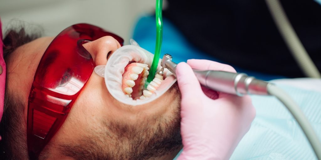 teeth cleaning