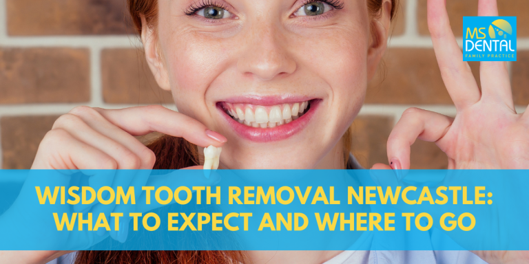 Wisdom Tooth Removal Newcastle: What to Expect and Where to Go