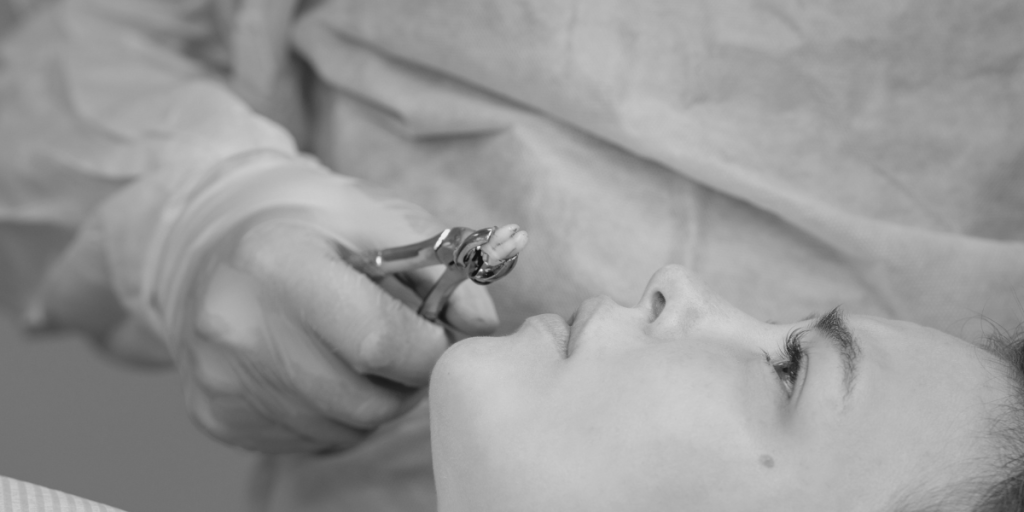 Dentist using forceps to remove a patient's wisdom tooth